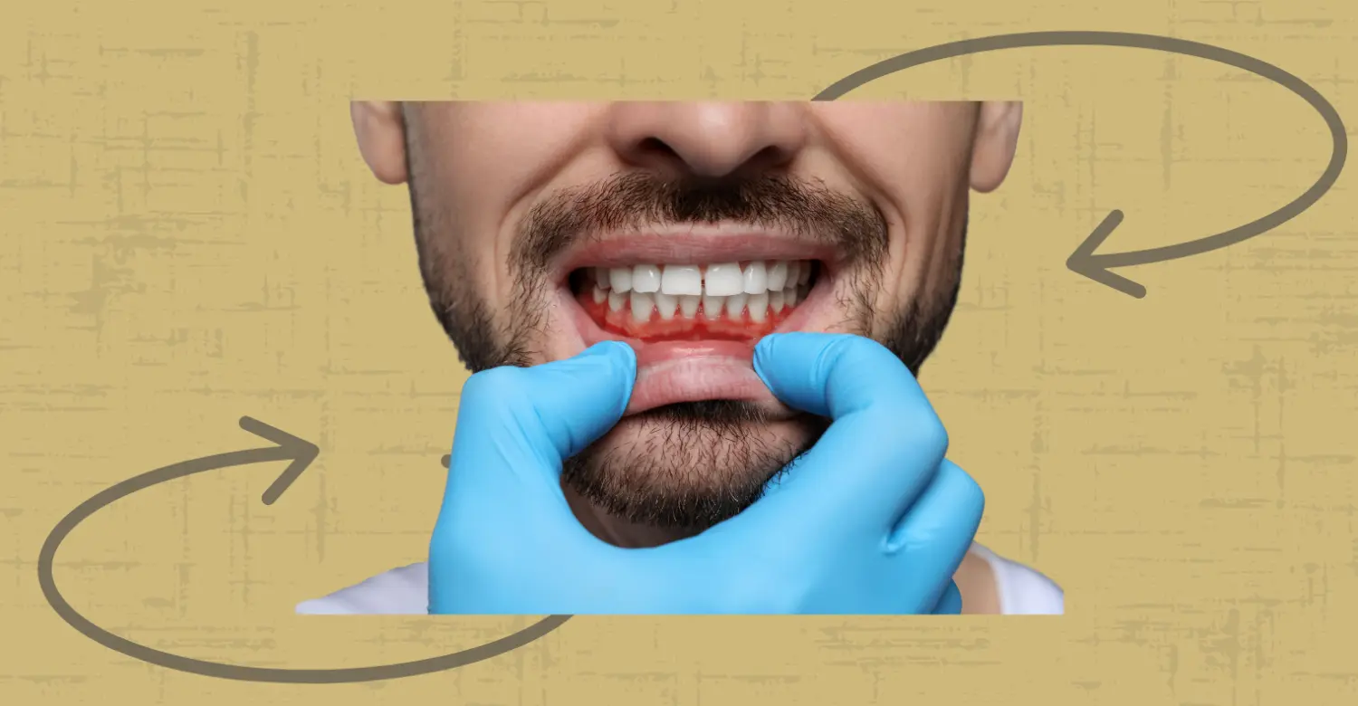 How to Maintain Gum Health 2